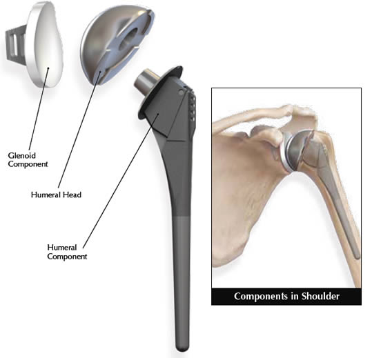 p shoulder components