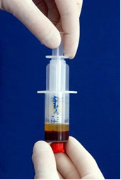 provided p prp syringe